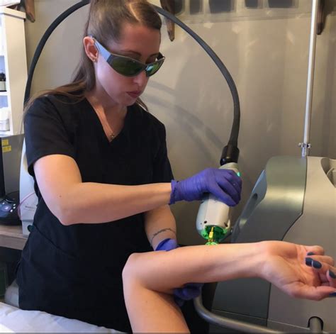 laser hair removal places near amery